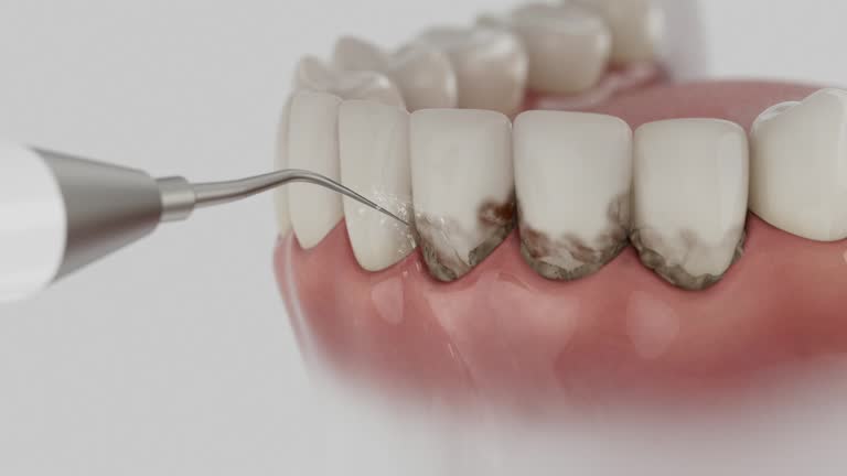 Reliable Dental contractor in Prairie Ridge, WA by Dentist Open Now